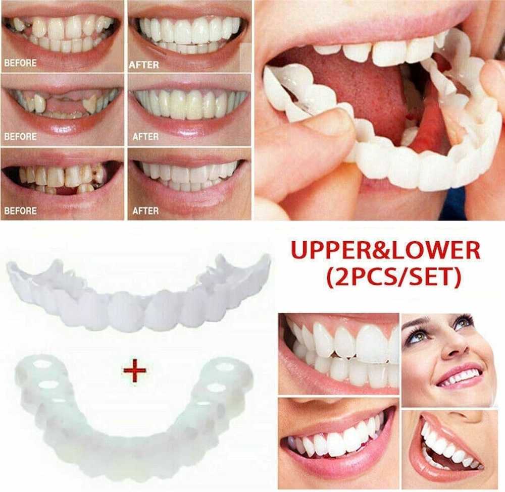 Snap-In Veneers | Instant Smile Teeth for Men & Women