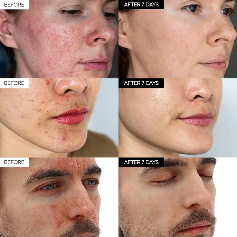 iVoskin Intensive Cica Repair Cream